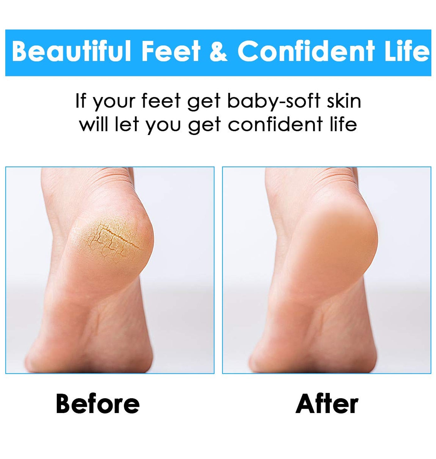 GOLDIFY Cordless Feet Callus Remover