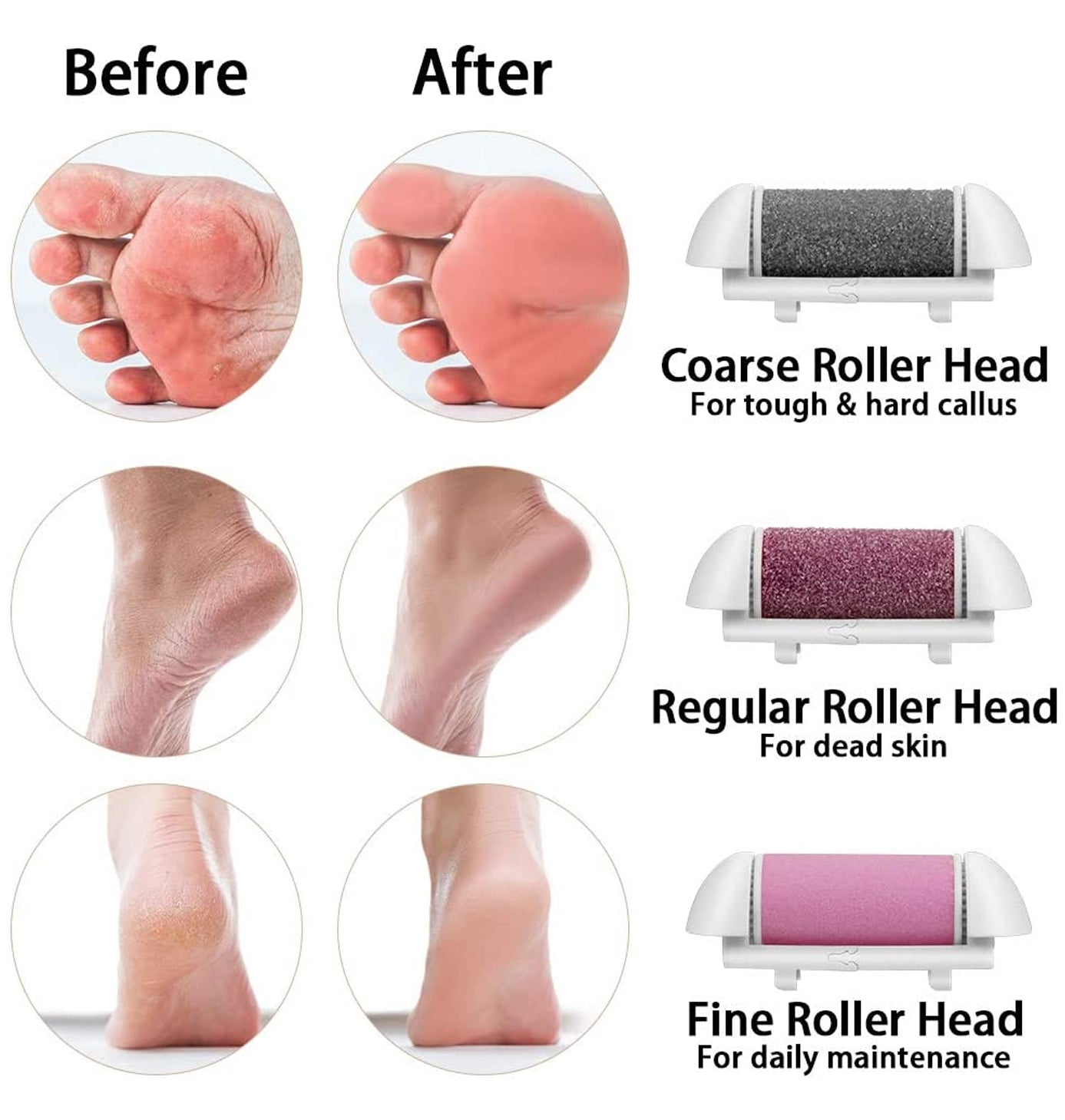 GOLDIFY Electric Feet Callus Remover with LED Display