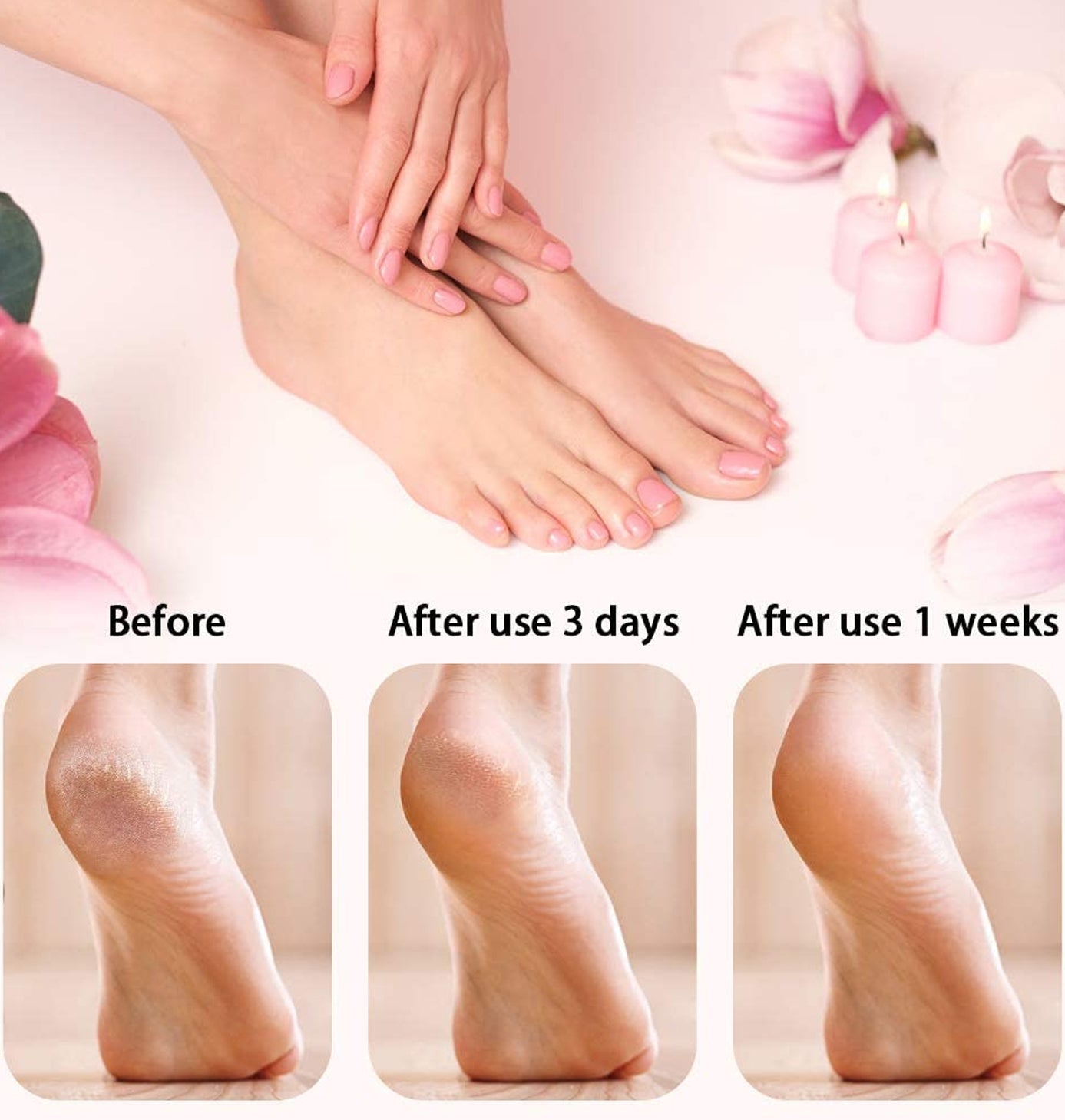 GOLDIFY Electric Feet Callus Remover with LED Display